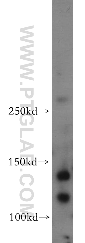 WB analysis of Neuro-2a using 20176-1-AP (same clone as 20176-1-PBS)