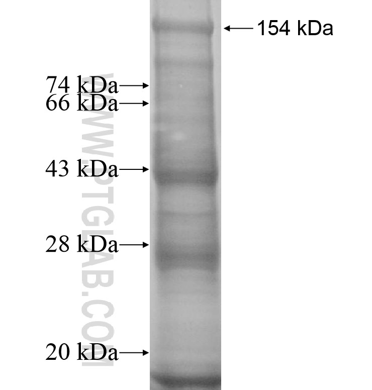 Trappc9,NIBP fusion protein Ag14016 SDS-PAGE Trappc9,NIBP fusion protein Ag14016 SDS-PAGE