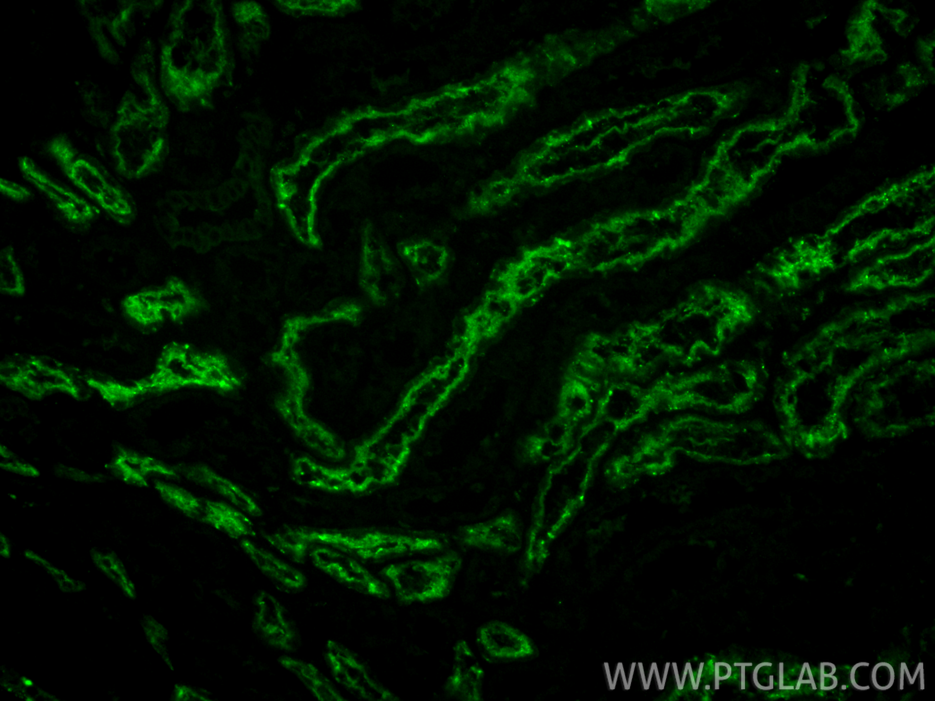 IF Staining of human kidney using 21685-1-AP