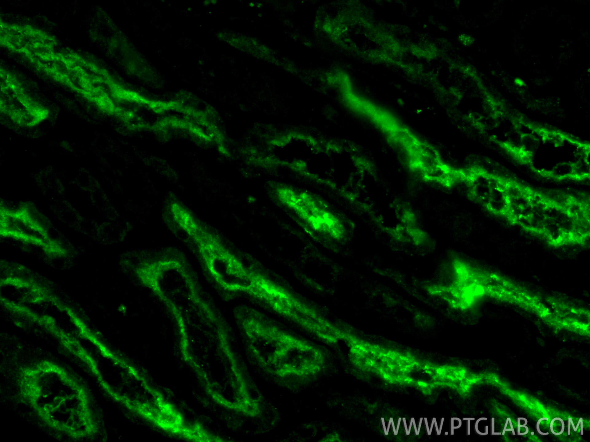 IF Staining of human kidney using 21685-1-AP