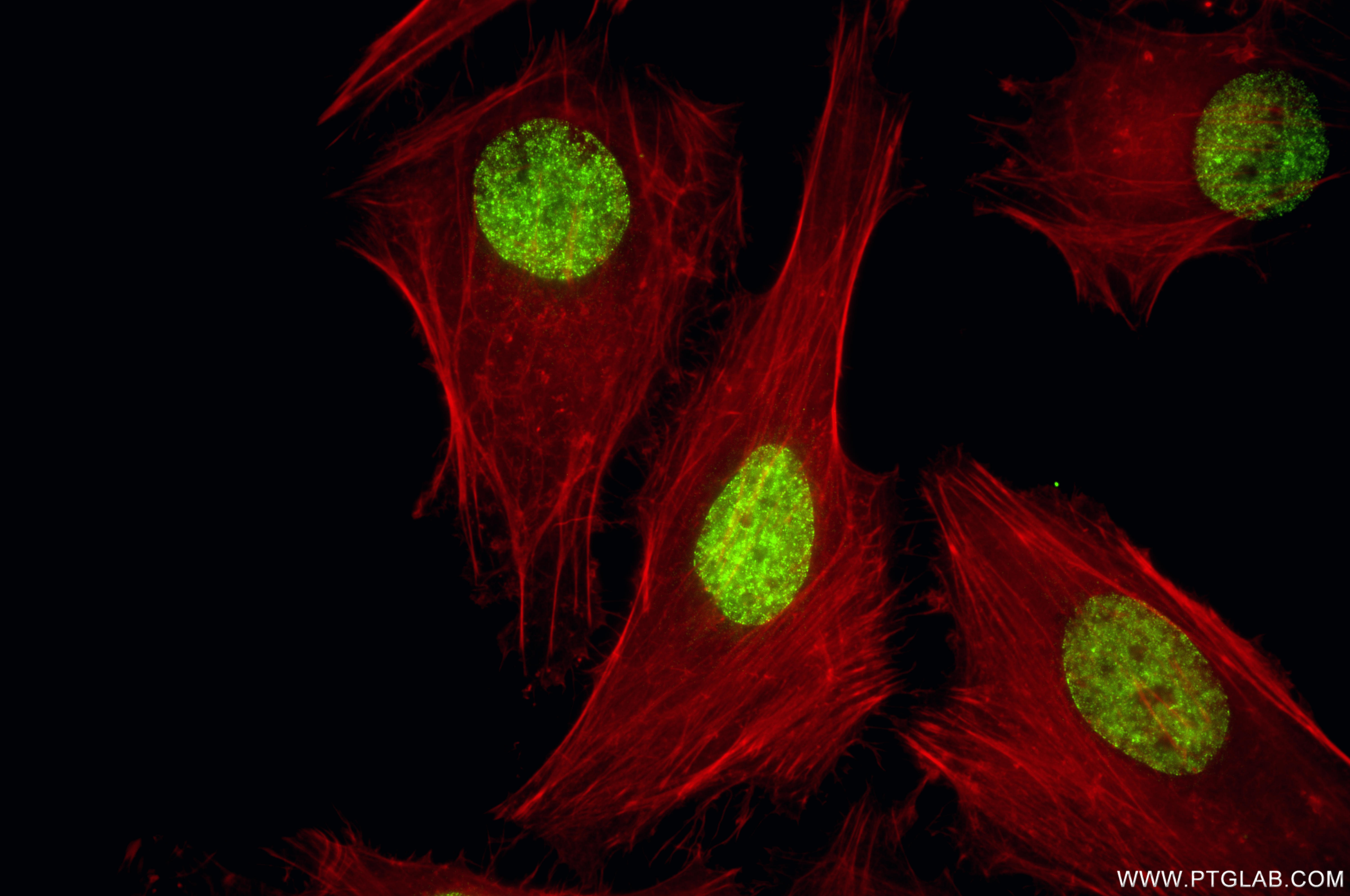 IF Staining of HeLa using 86992-1-RR (same clone as 86992-1-PBS)