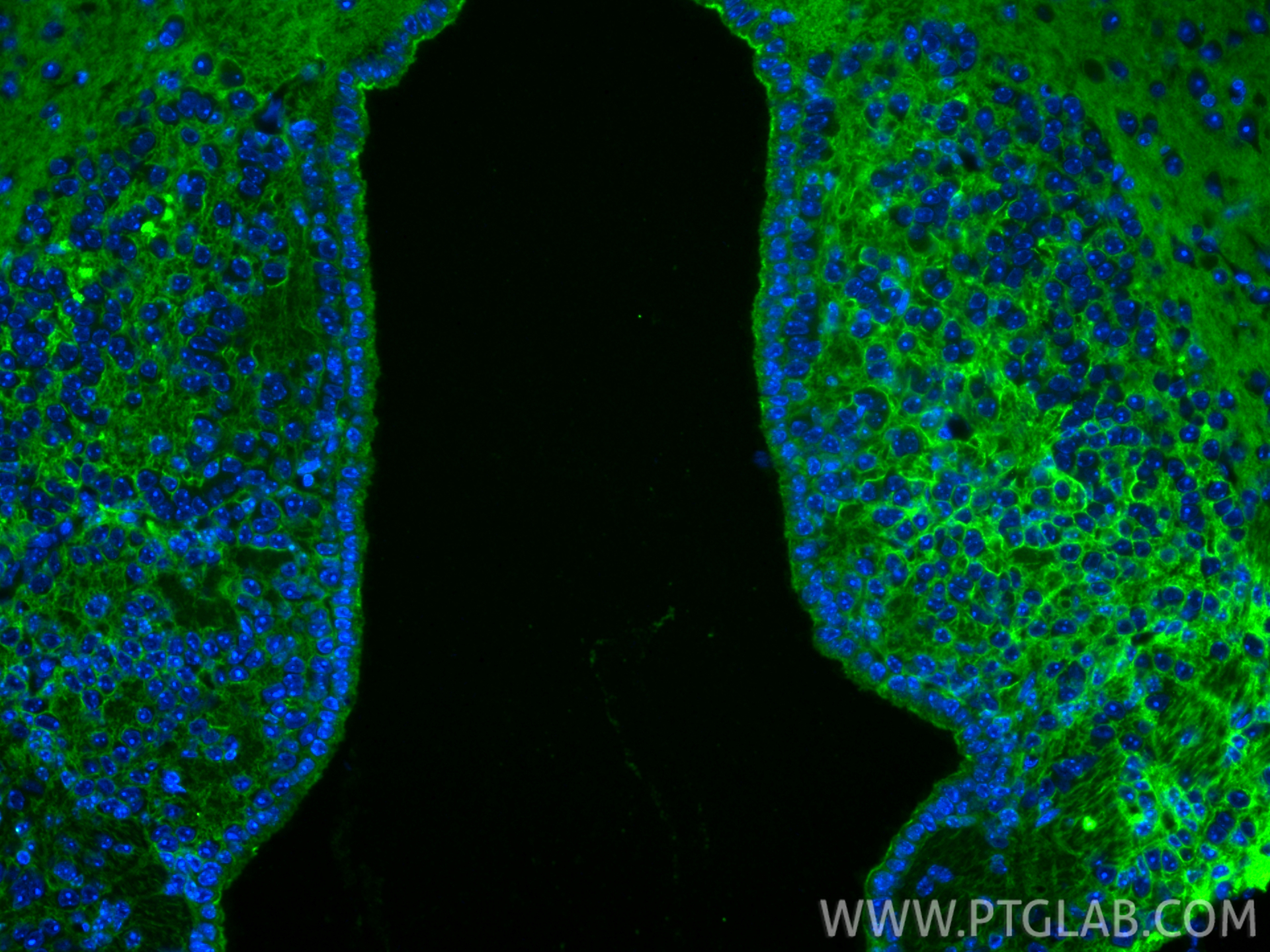 IF Staining of mouse brain using 33093-1-AP