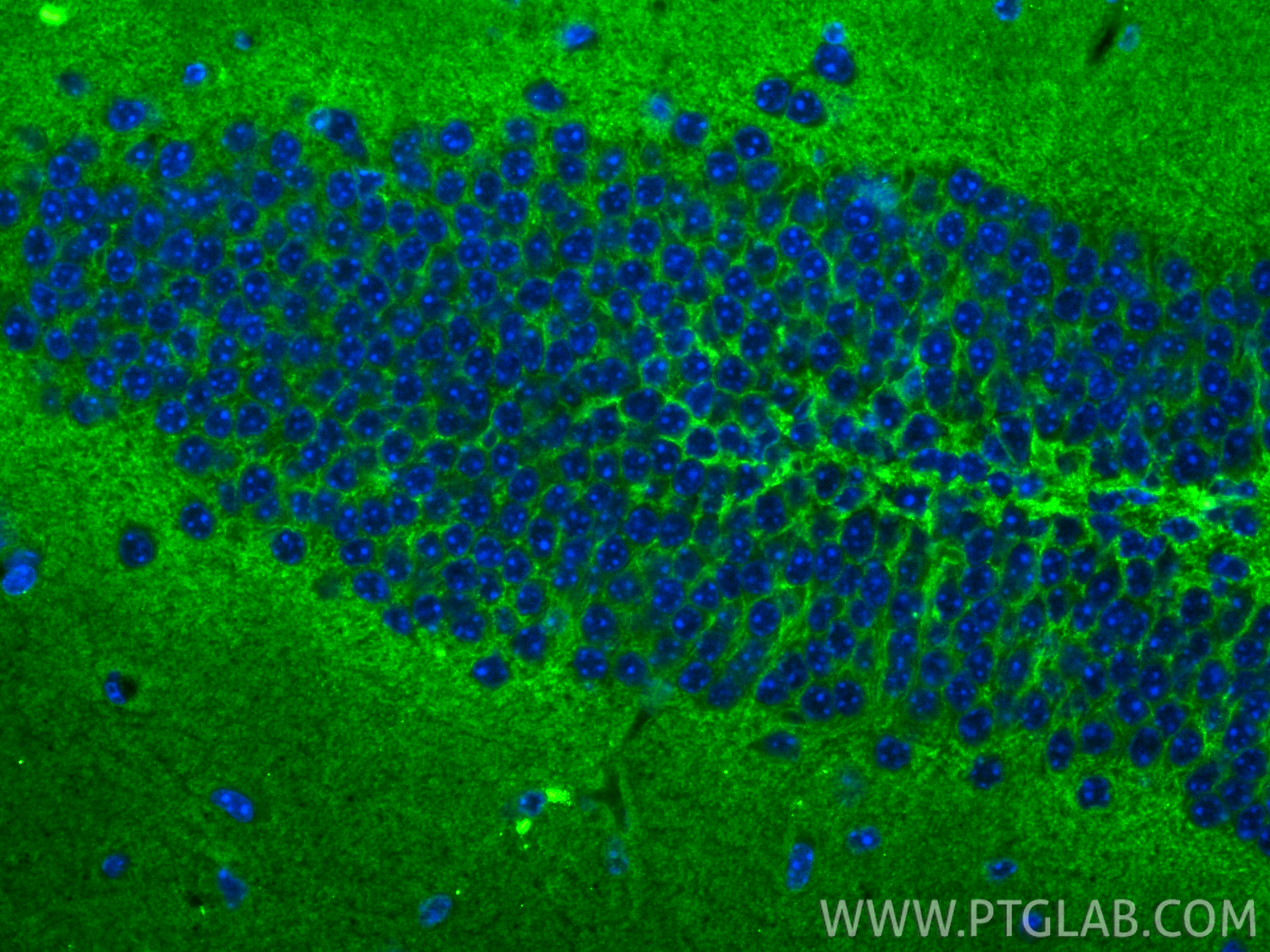 IF Staining of mouse brain using 33093-1-AP