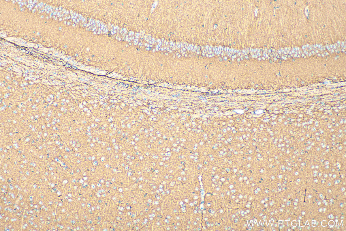 IHC staining of mouse brain using 33093-1-AP