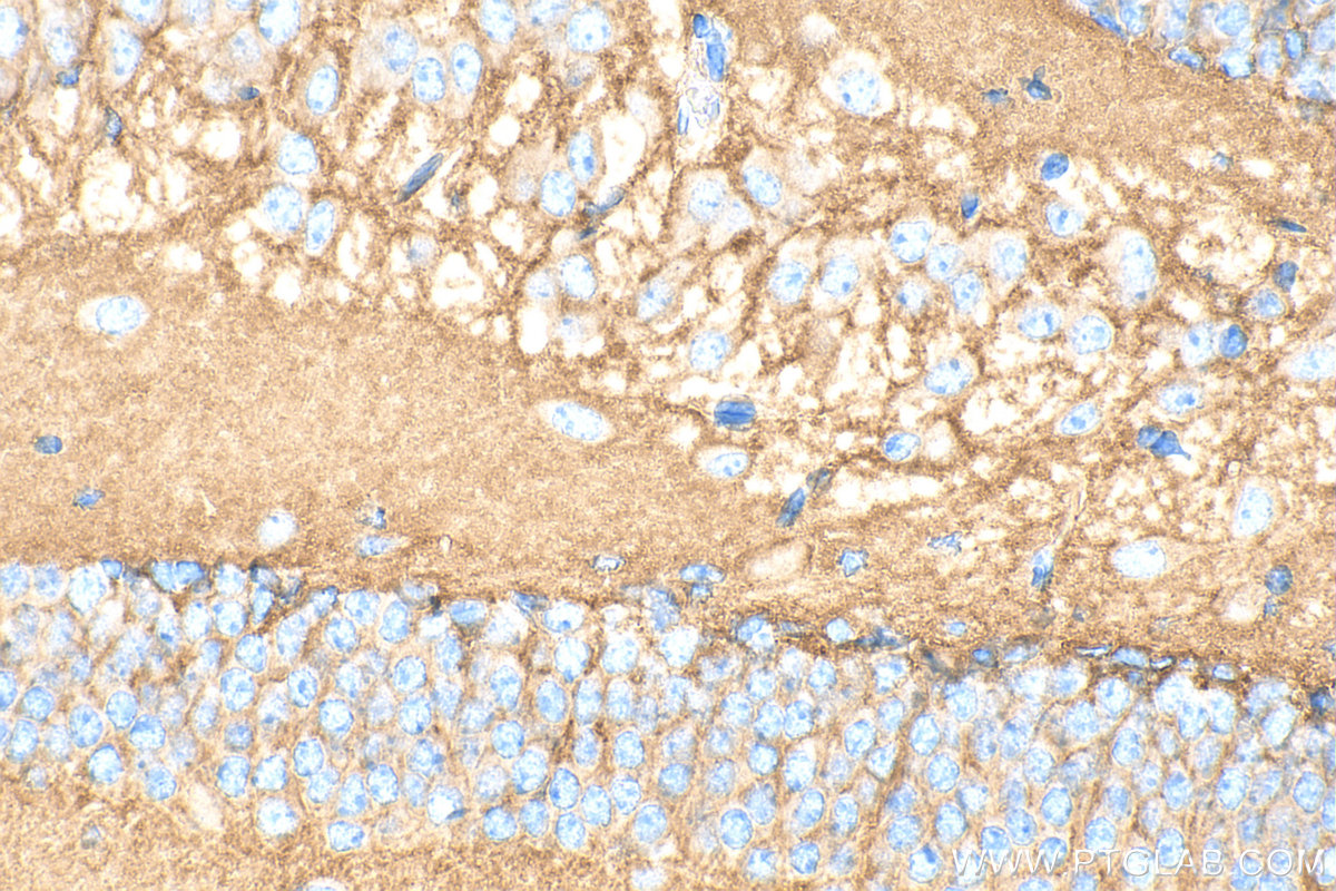 IHC staining of mouse brain using 33093-1-AP