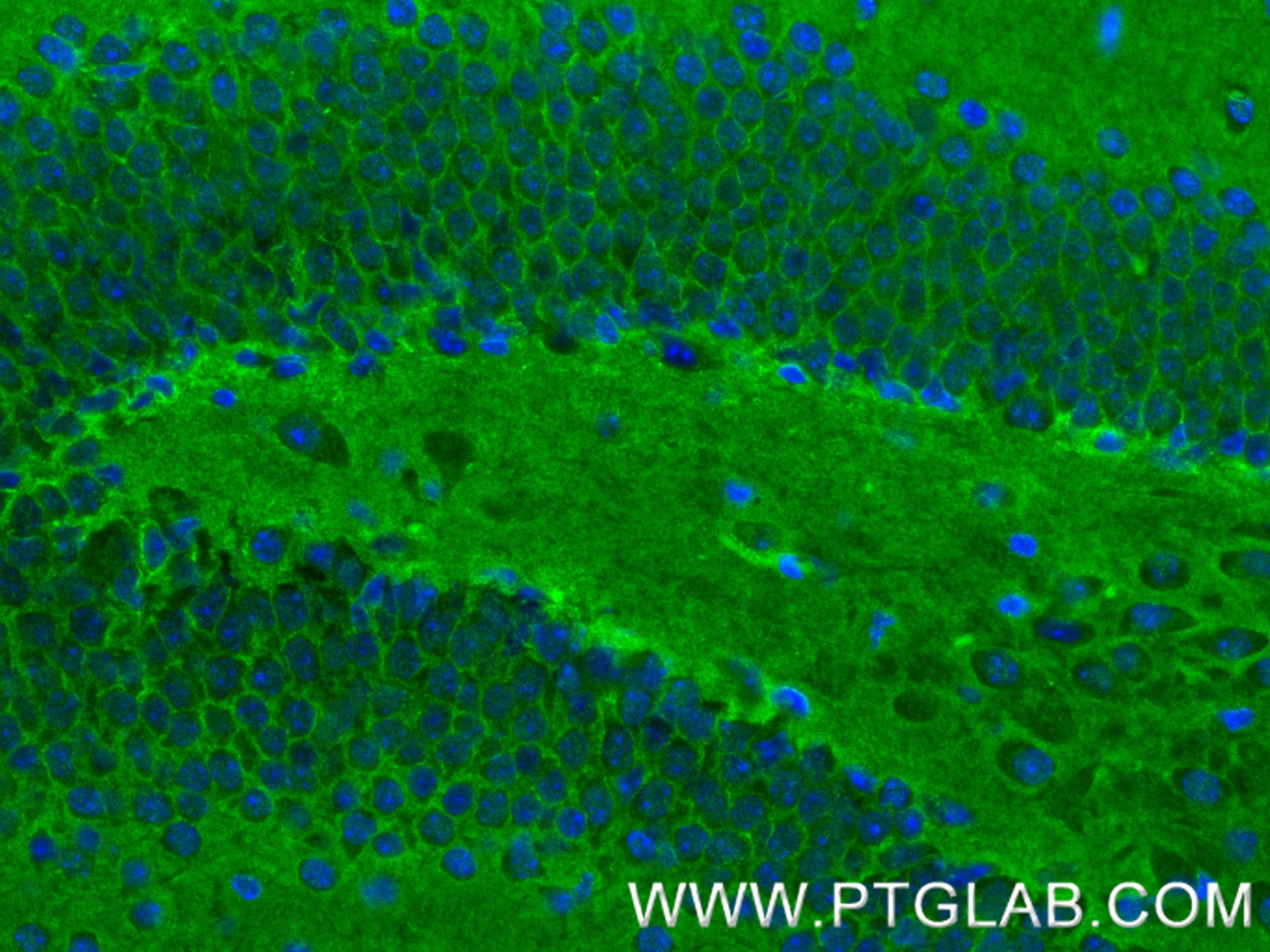 IF Staining of mouse brain using 80878-6-RR