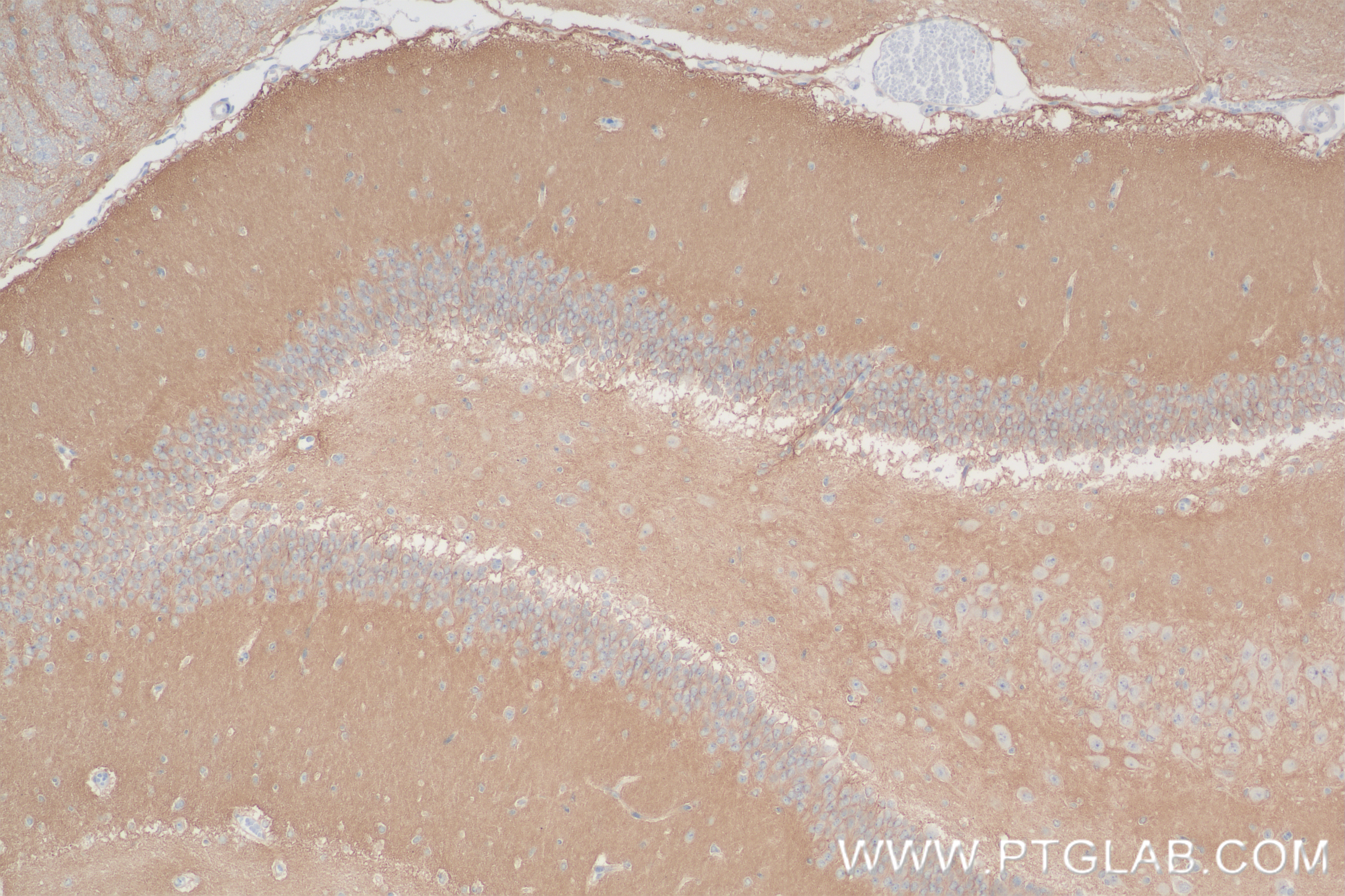 IHC staining of rat brain using 80878-6-RR (same clone as 80878-6-PBS)