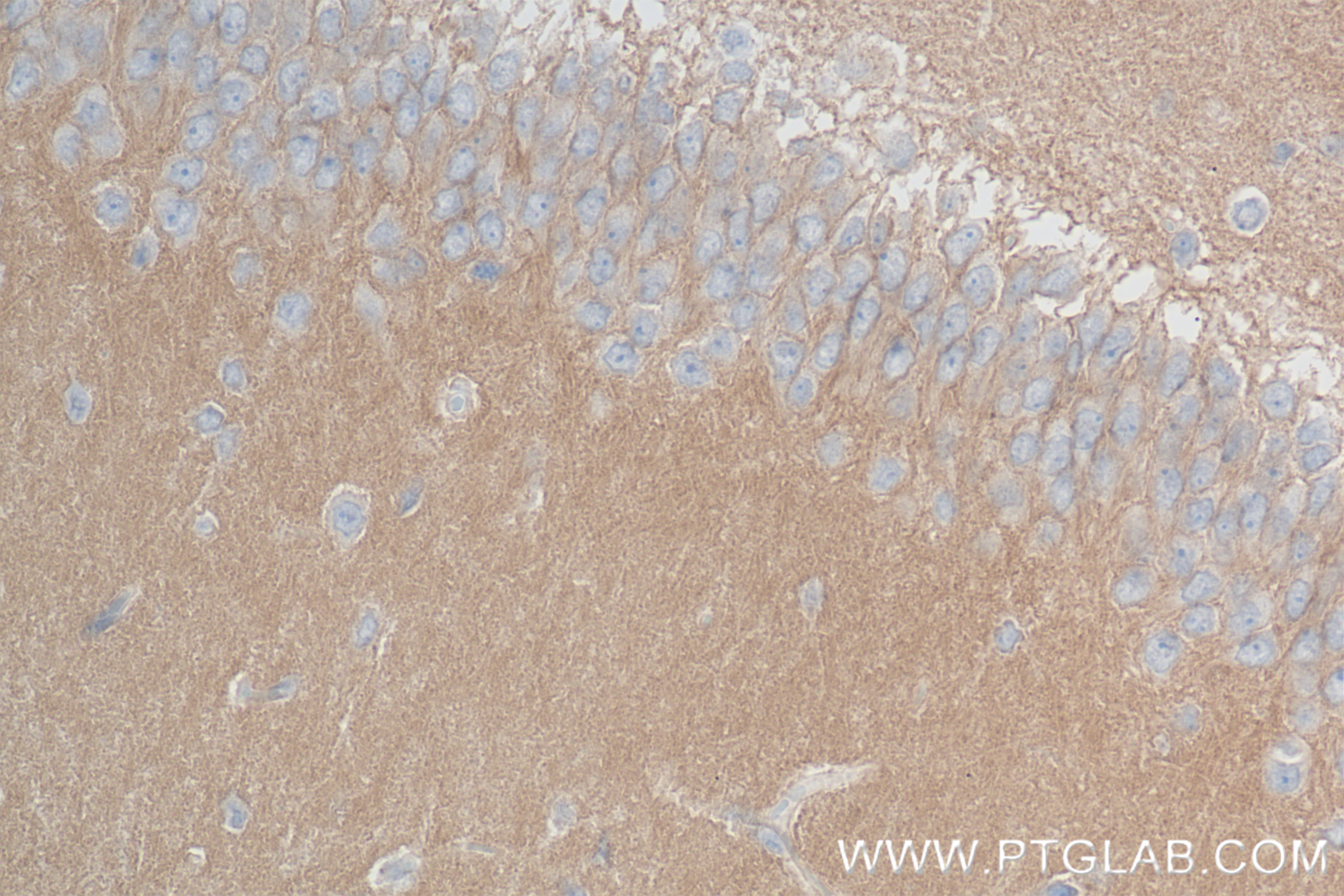 IHC staining of rat brain using 80878-6-RR (same clone as 80878-6-PBS)