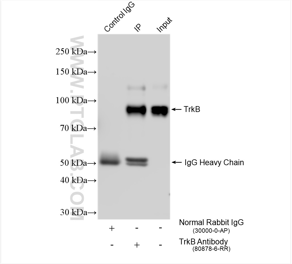 IP experiment of mouse cerebellum using 80878-6-RR (same clone as 80878-6-PBS)