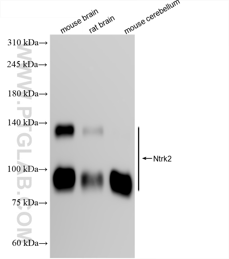 Various lysates were subjected to SDS PAGE followed by western blot with 85971-3-RR (TrkB antibody) at dilution of 1:10000 incubated at room temperature for 1.5 hours. WB analysis of mouse brain using 85971-3-RR