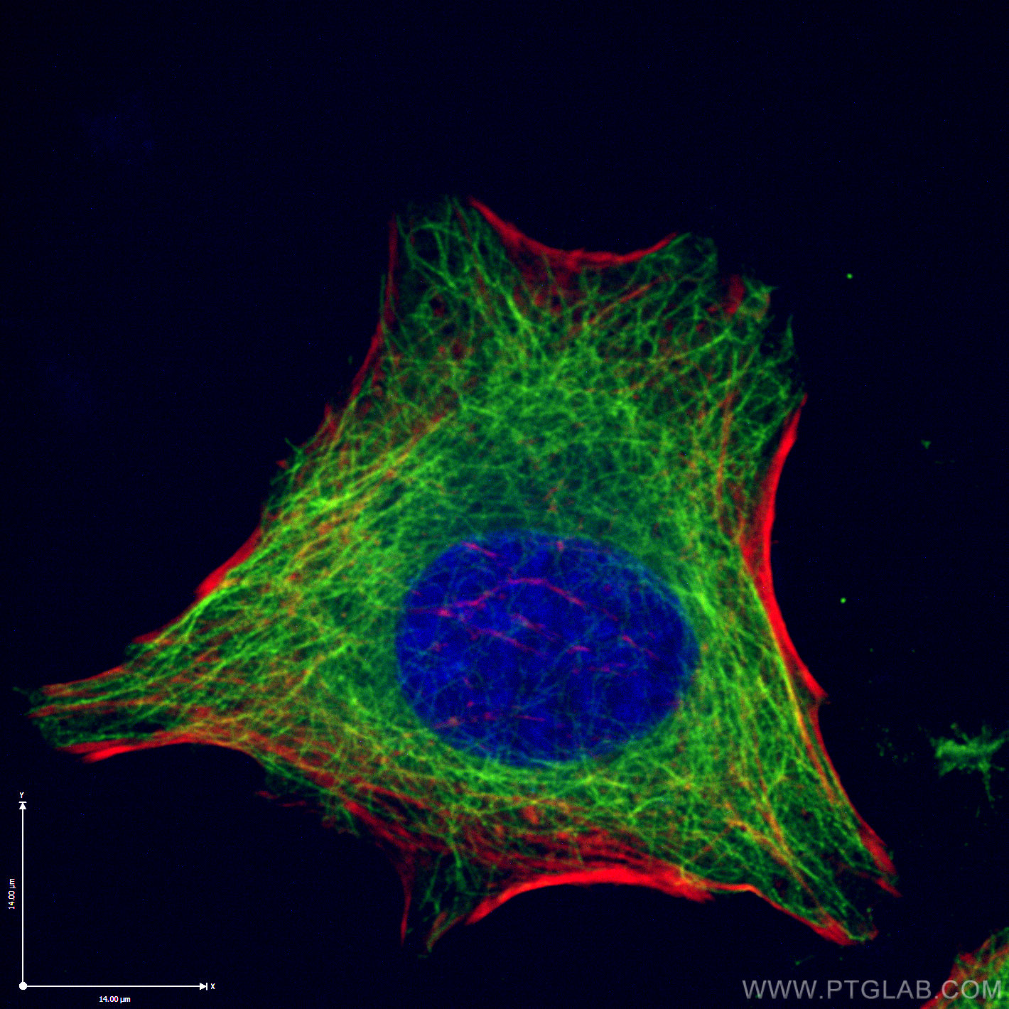 IF Staining of HeLa using 66240-1-Ig (same clone as 66240-1-PBS)