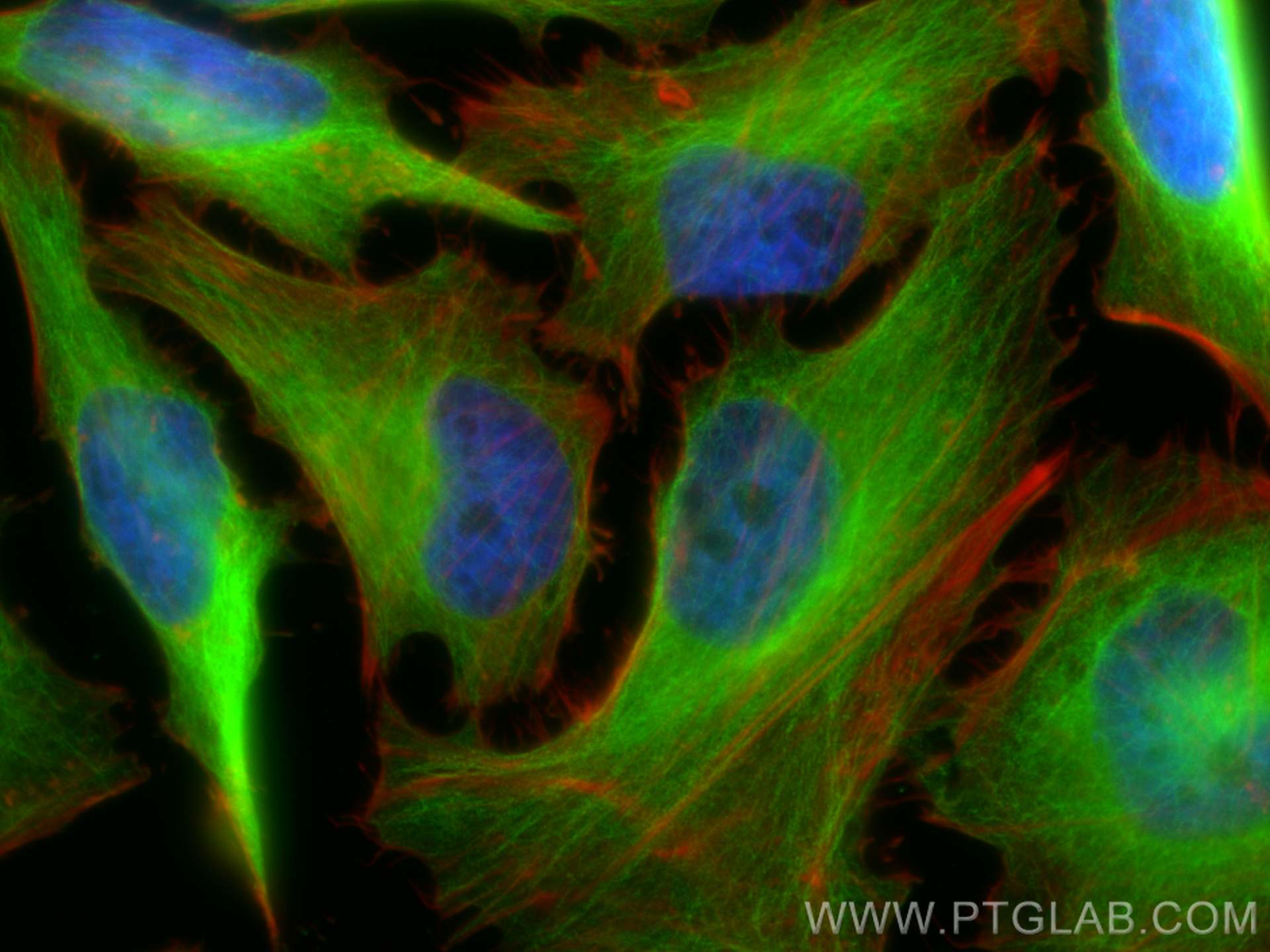 IF Staining of HeLa using 66240-1-Ig (same clone as 66240-1-PBS)