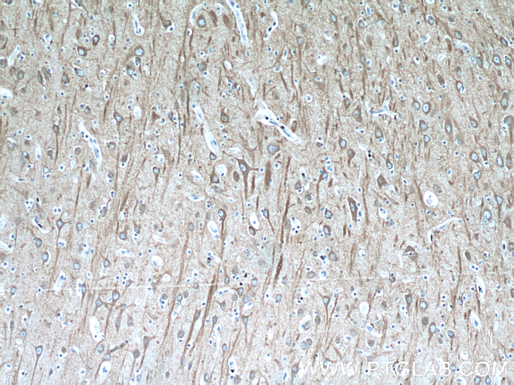 IHC staining of human brain using 66240-1-Ig (same clone as 66240-1-PBS)