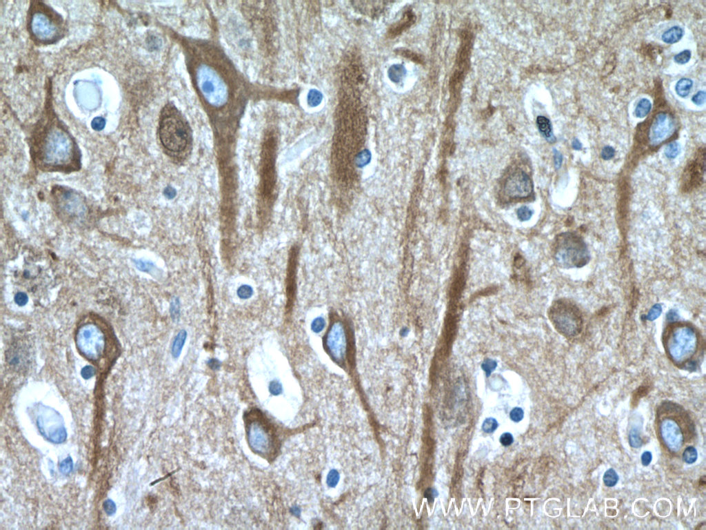 IHC staining of human brain using 66240-1-Ig (same clone as 66240-1-PBS)