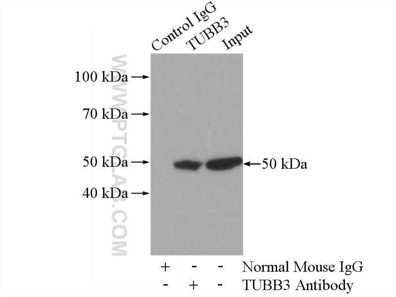 IP experiment of HeLa using 66240-1-Ig (same clone as 66240-1-PBS)