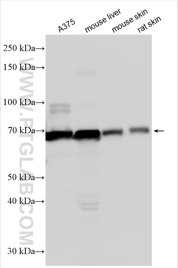 WB analysis using 31291-1-AP