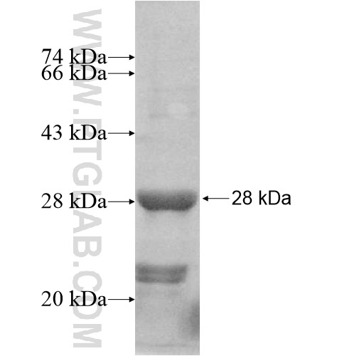 U2AF1L4 fusion protein Ag10949 SDS-PAGE U2AF1L4 fusion protein Ag10949 SDS-PAGE