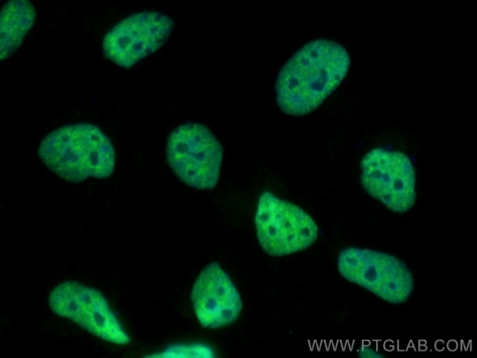 IF Staining of HEK-293 using 68166-1-Ig (same clone as 68166-1-PBS)