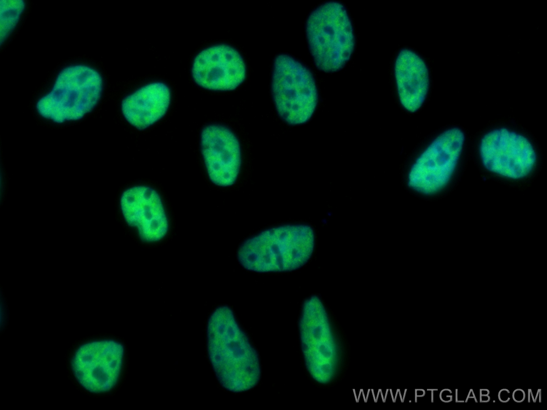 IF Staining of HEK-293 using 68166-1-Ig (same clone as 68166-1-PBS)