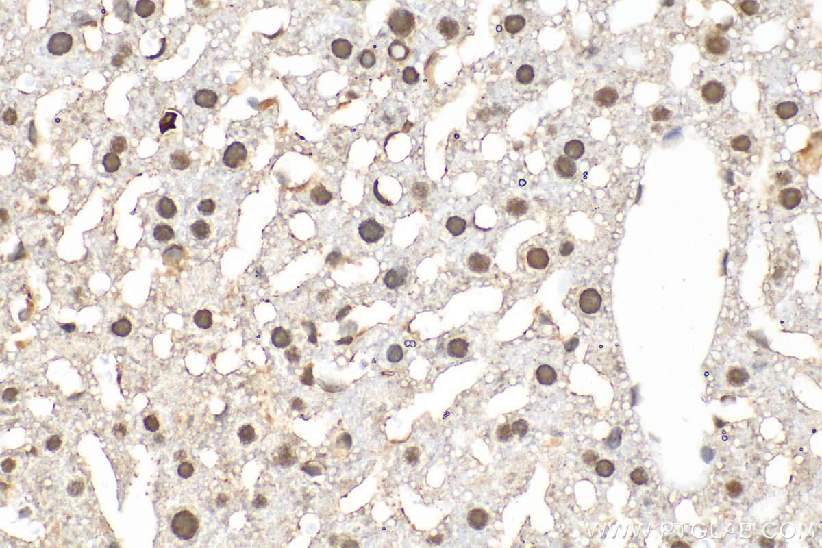 IHC staining of mouse liver using 68166-1-Ig (same clone as 68166-1-PBS)