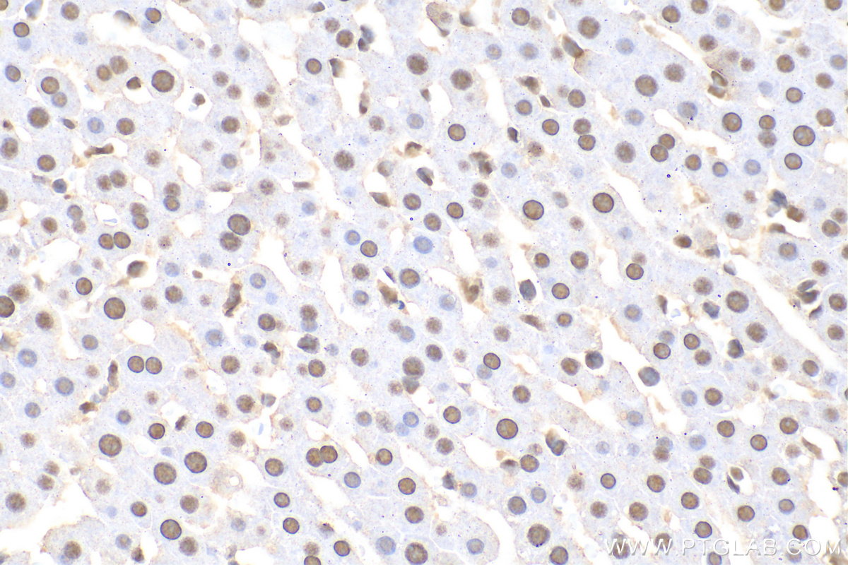 IHC staining of rat liver using 68166-1-Ig
