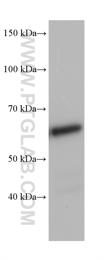 WB analysis of 4T1 using 68166-1-Ig