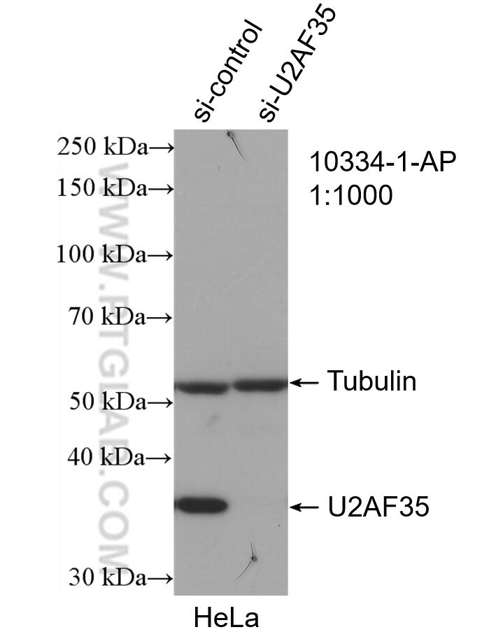 WB analysis of HeLa using 10334-1-AP