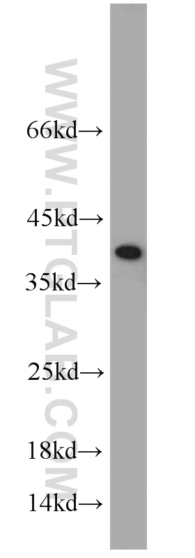 WB analysis of COLO 320 using 10334-1-AP