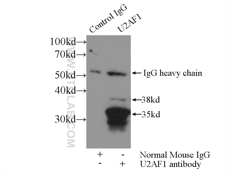 IP experiment of HeLa using 60289-1-Ig