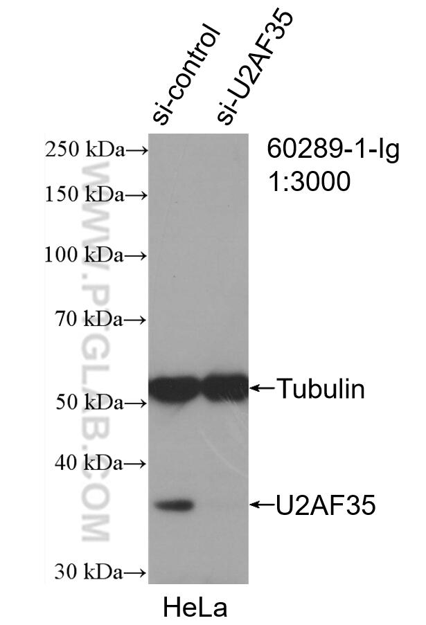 WB analysis of HeLa using 60289-1-Ig