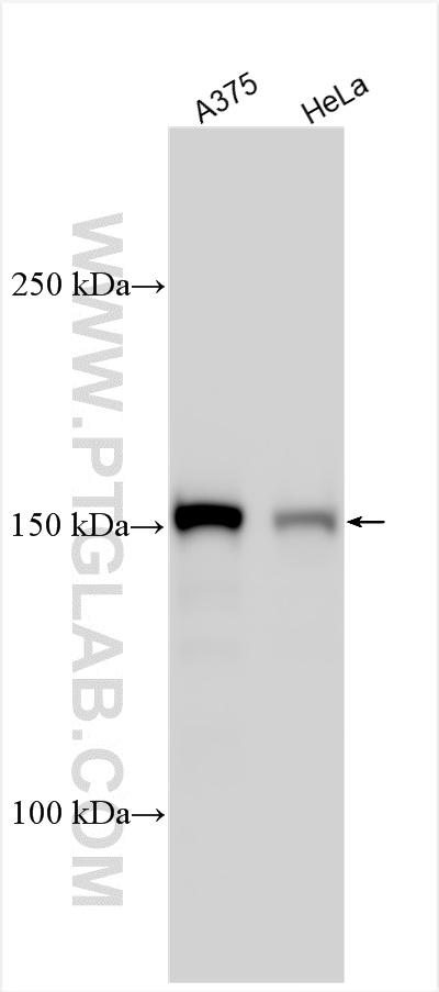 WB analysis using 25654-1-AP