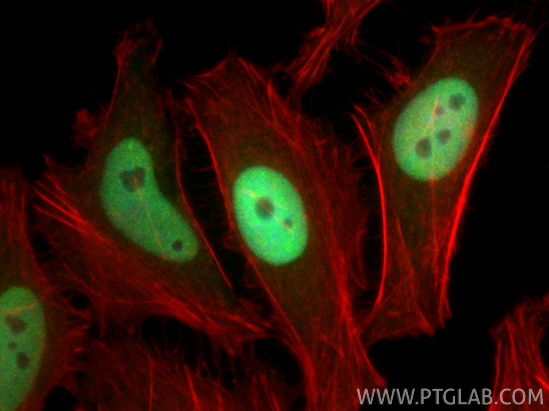 Immunofluorescent analysis of (4% PFA) fixed HeLa cells using UBA2 antibody (15347-1-AP) at dilution of 1:600 and CoraLite®488-Conjugated Goat Anti-Rabbit IgG(H+L) (<a class='green' href='/productredirect?CatalogNo=SA00013-2' target='_blank'>SA00013-2</a>), CL594-phalloidin (red). IF Staining of HeLa using 15347-1-AP