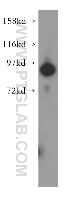 UBA2 Polyclonal antibody