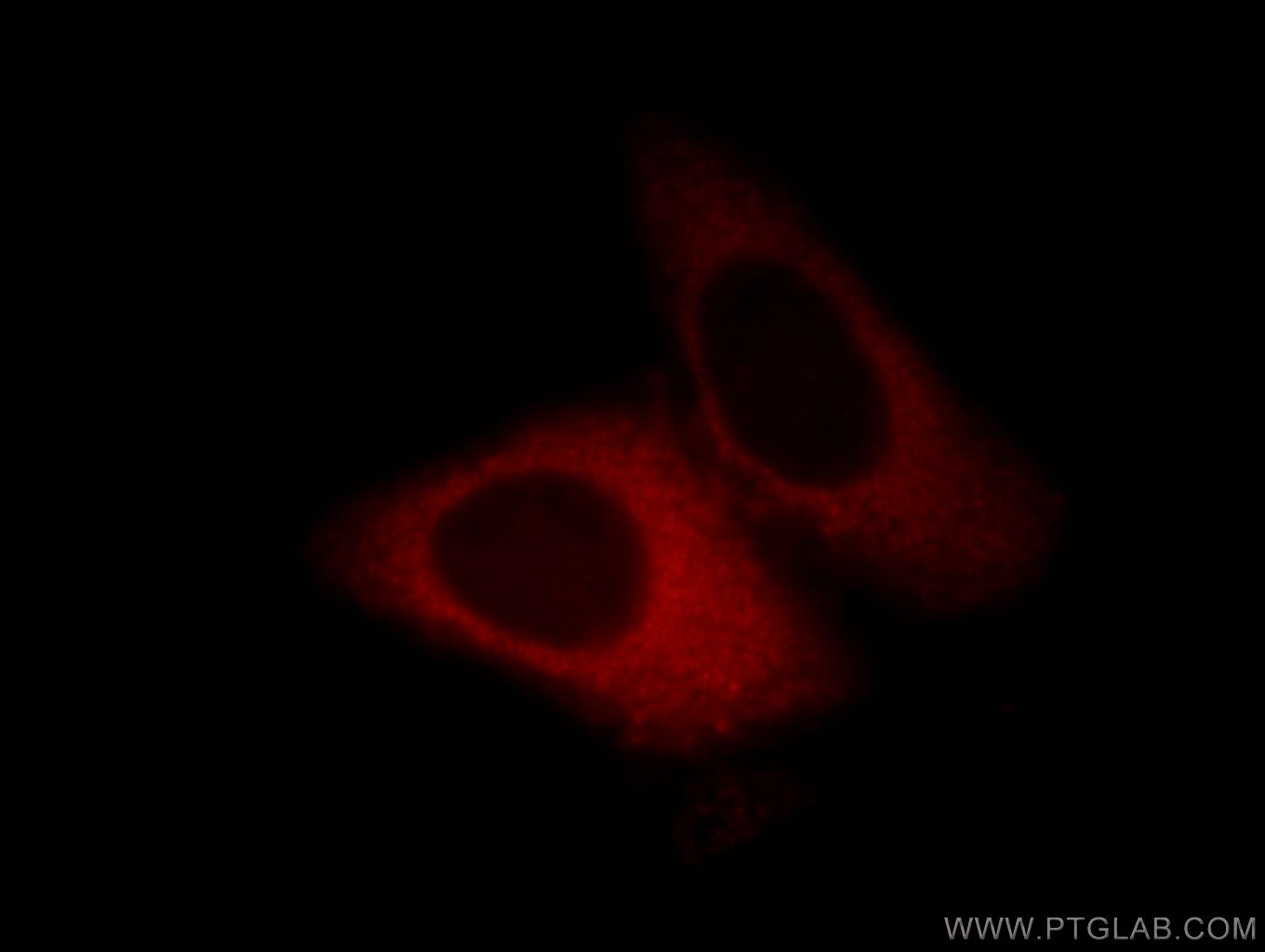 IF Staining of HepG2 using 12093-1-AP