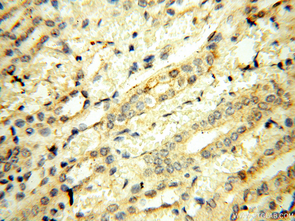 UBA52 Polyclonal antibody