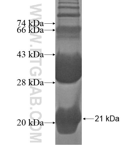 UBA52 fusion protein Ag12687 SDS-PAGE UBA52 fusion protein Ag12687 SDS-PAGE