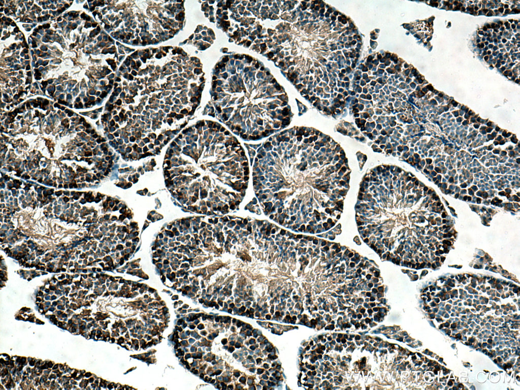 IHC staining of mouse testis using 13211-1-AP