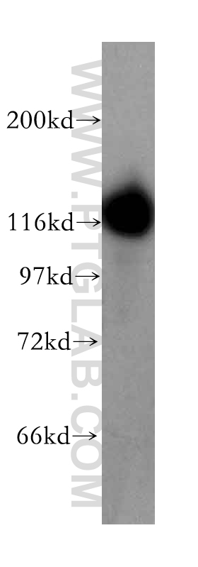 UBA6 Polyclonal antibody