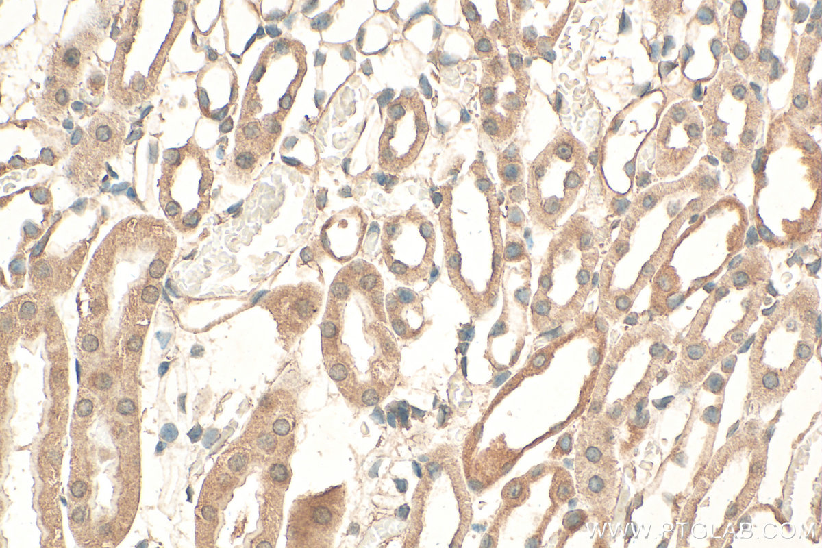 IHC staining of mouse kidney using 15818-1-AP