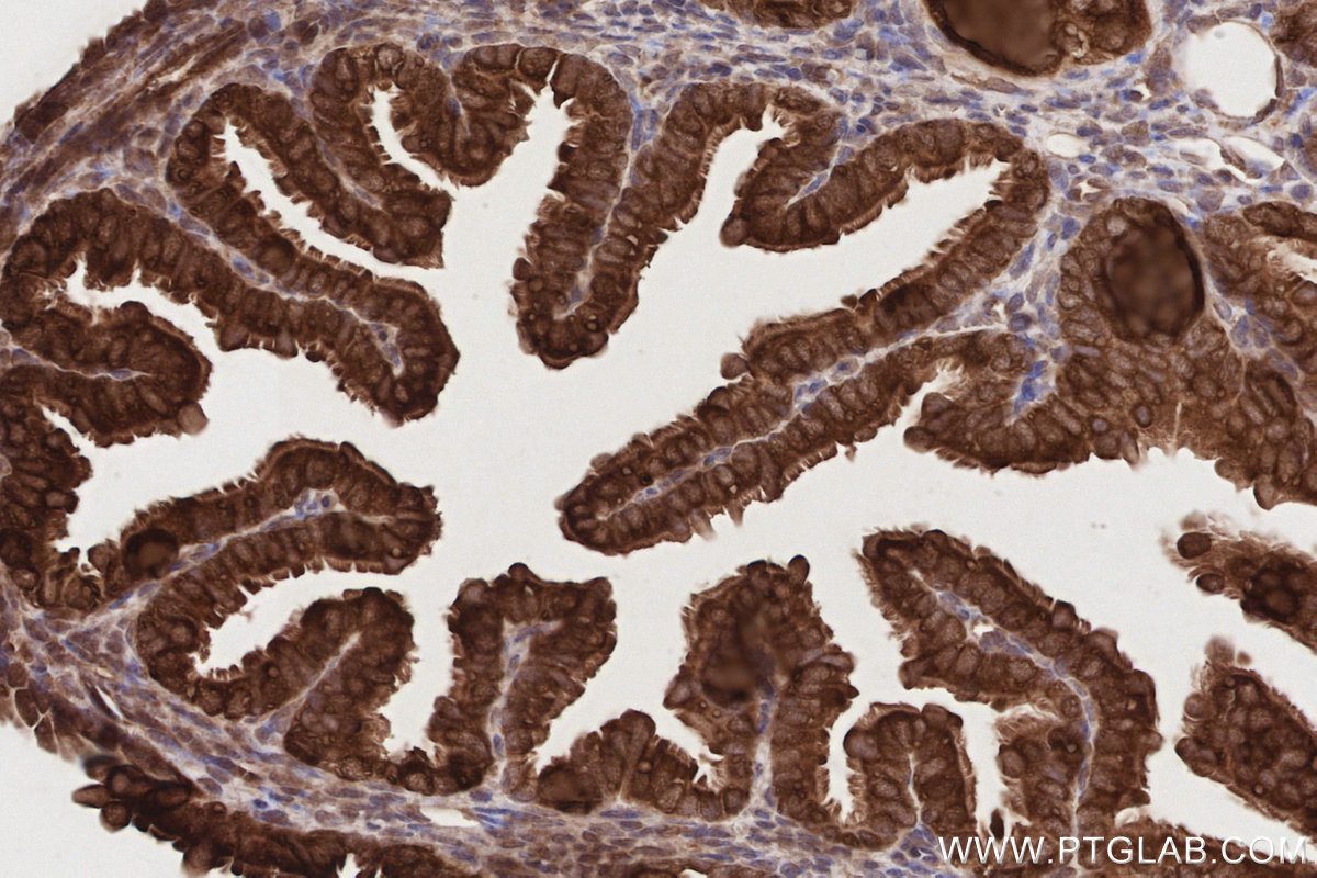 IHC staining of mouse ovary using 19844-1-AP IHC staining of mouse ovary using 19844-1-AP