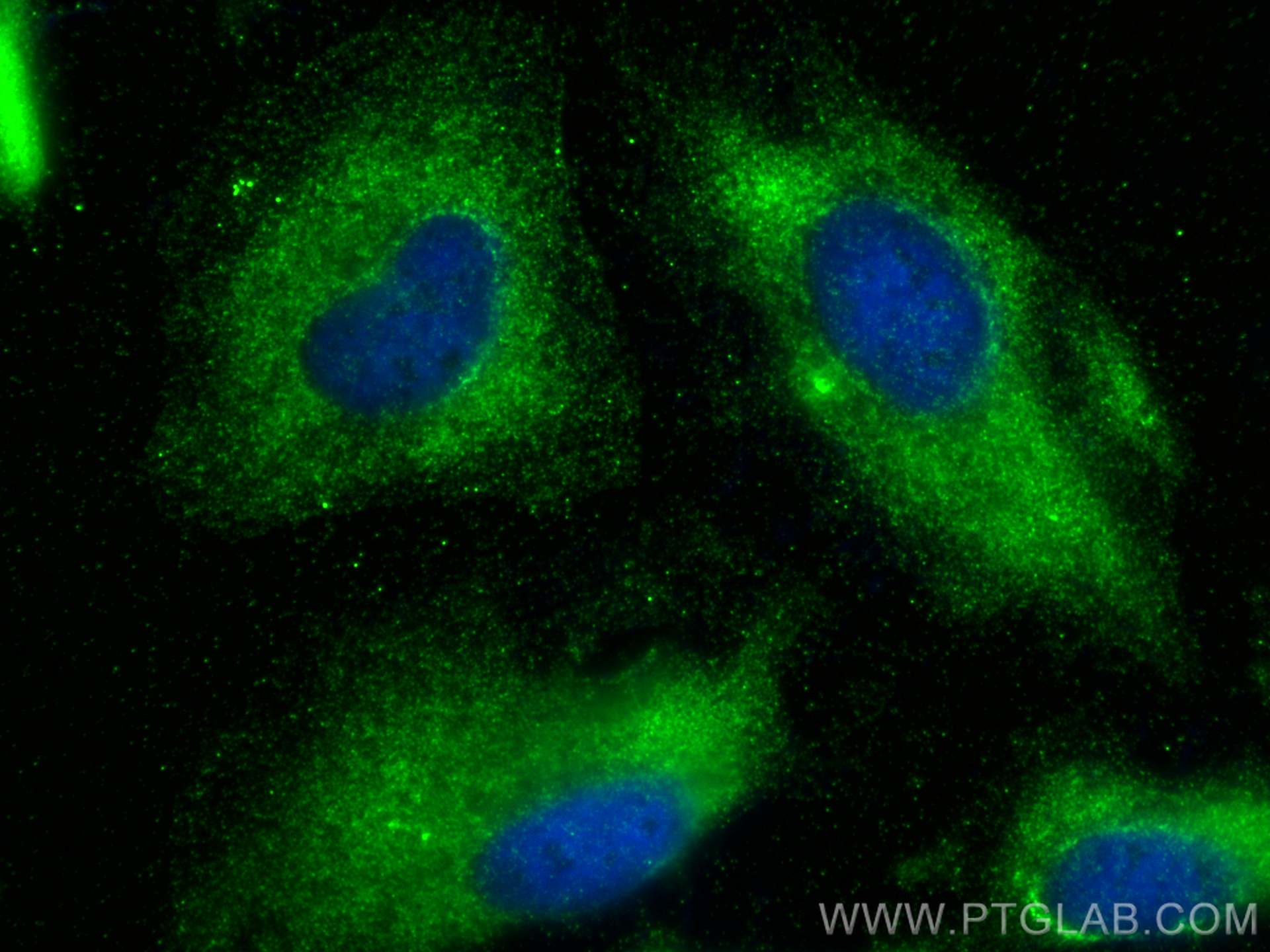 IF Staining of HeLa using 67385-1-Ig