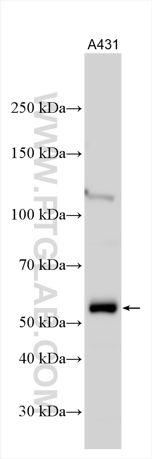 WB analysis using 12385-1-AP