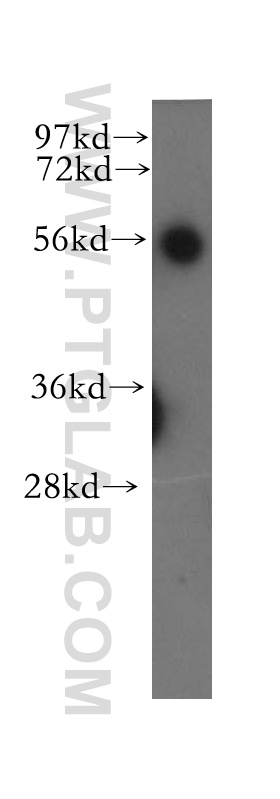 WB analysis of human heart using 12385-1-AP