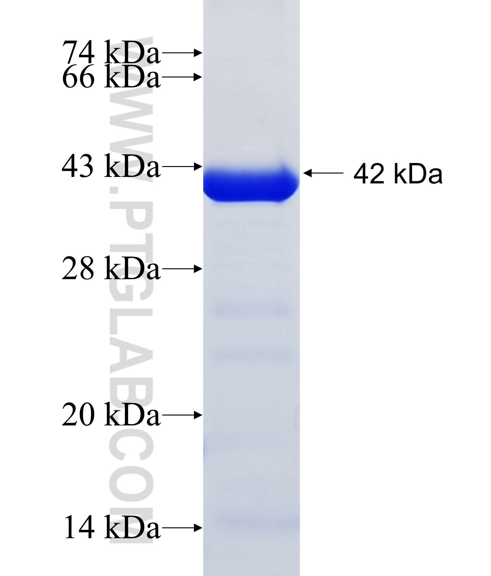 UBAP1L fusion protein Ag34827 SDS-PAGE UBAP1L fusion protein Ag34827 SDS-PAGE