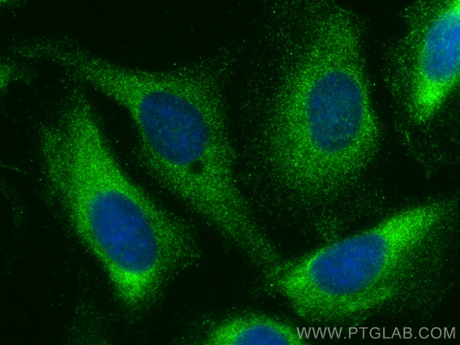 IF Staining of U2OS using 29628-1-AP
