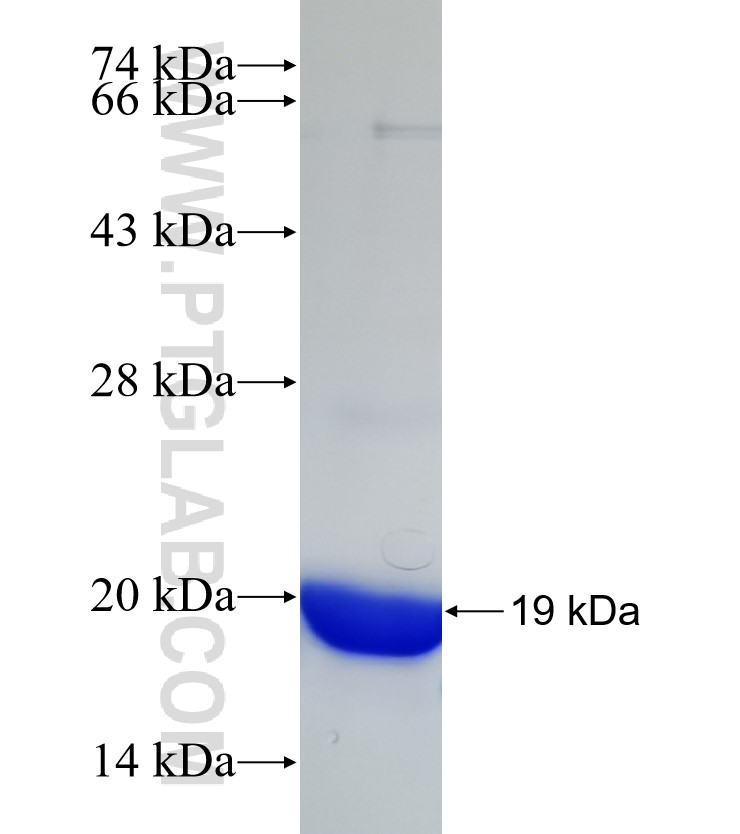 UBAP2 fusion protein Ag30588 SDS-PAGE