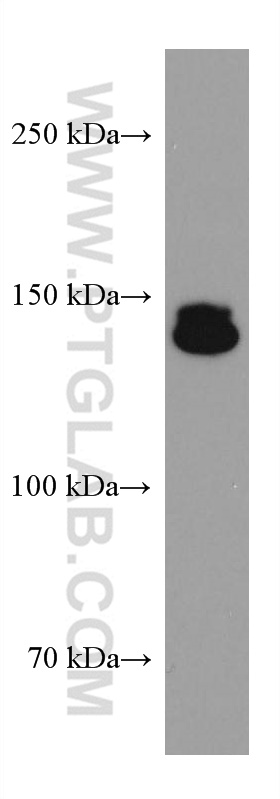WB analysis of K-562 using 67588-1-Ig