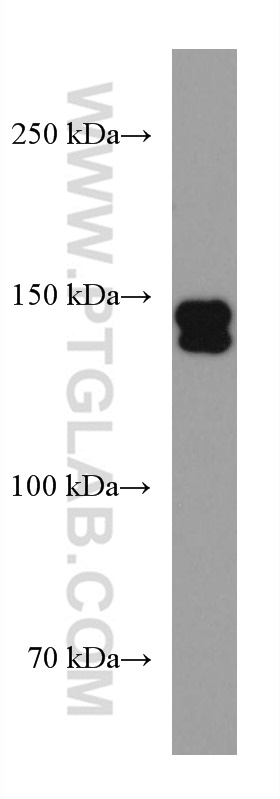 WB analysis of HEK-293 using 67588-1-Ig