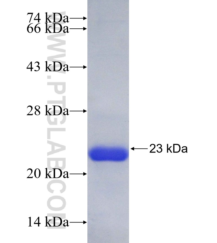UBAP2L fusion protein Ag30125 SDS-PAGE