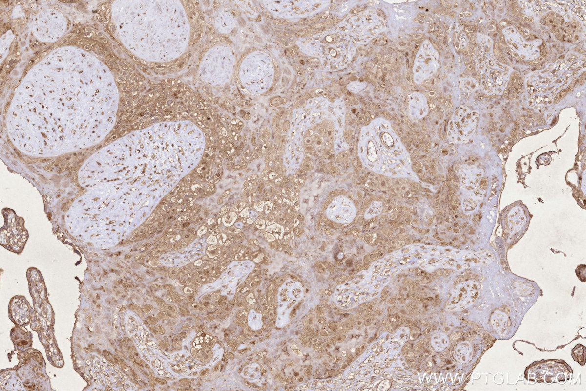 IHC staining of human placenta using 14520-1-AP IHC staining of human placenta using 14520-1-AP
